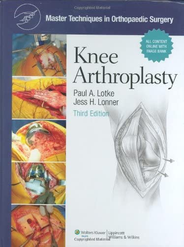 Master Techniques in Orthopaedic Surgery, Knee Arthroplasty