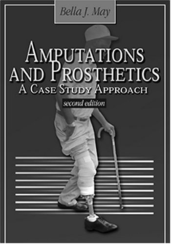 Amputations and Prosthetics