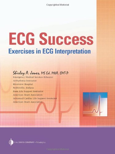 ECG Success