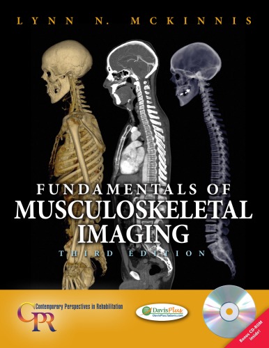 Fundamentals of Musculoskeletal Imaging [With CDROM]