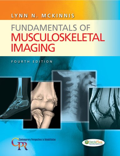 Fundamentals of Musculoskeletal Imaging