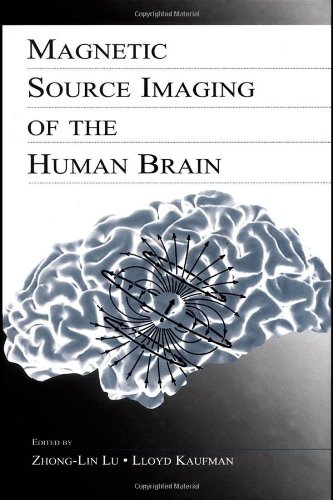 Magnetic Source Imaging of the Human Brain