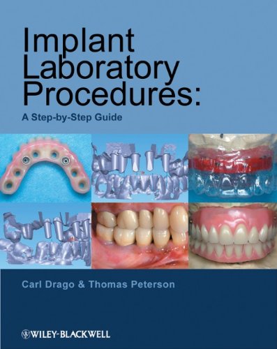 Implant Laboratory Procedures