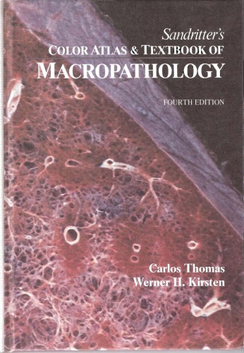 Sandritter's Color Atlas &amp; Textbook Of Macropathology