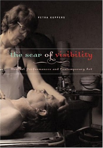 The Scar of Visibility