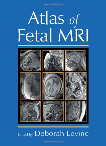 Atlas of Fetal MRI