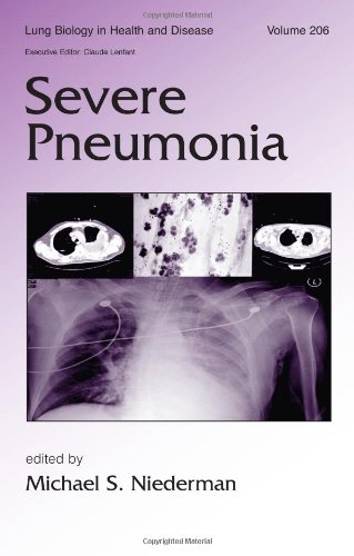 Severe Pneumonia