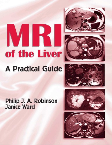 MRI of the Liver