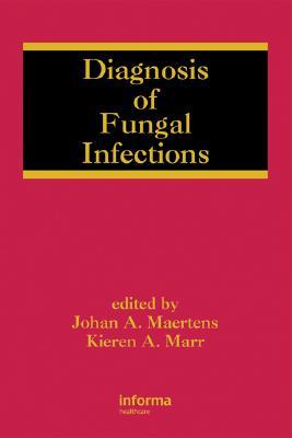 Diagnosis of Fungal Infections