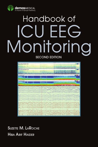 Handbook of ICU Eeg Monitoring, Second Edition