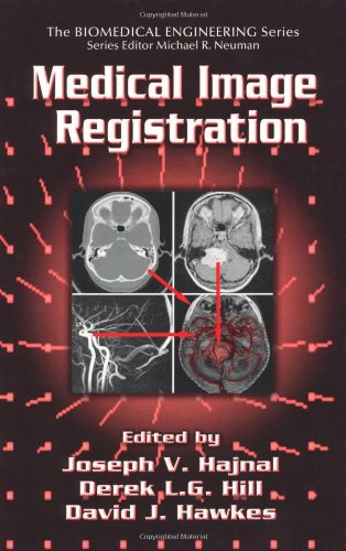 Medical Image Registration