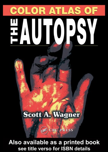 Color Atlas of the Autopsy