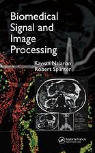 Biomedical Signal and Image Processing