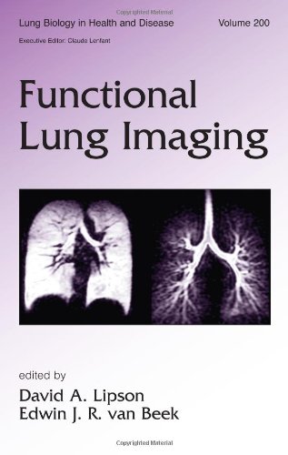 Functional Lung Imaging. Lung Biology in Health and Disease Series