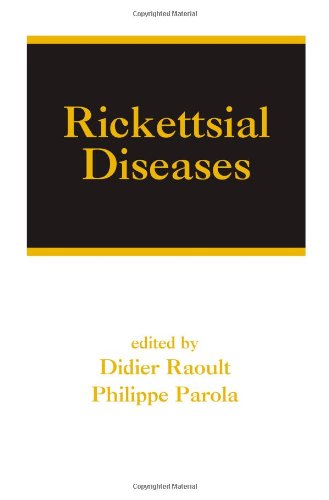 Rickettsial Diseases