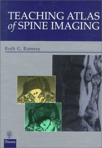 Teaching Atlas of Spine Imaging