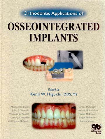 Orthodontic Applications of Osseointegrated Implants