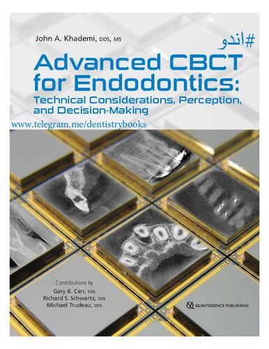 Advanced Cbct for Endodontics