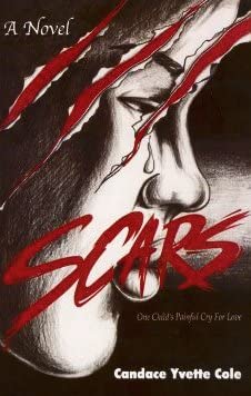 Scars (A Novel Based on a True Story)