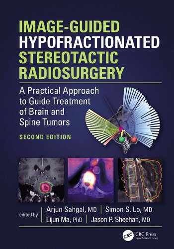 Image-Guided Hypofractionated Stereotactic Radiosurgery