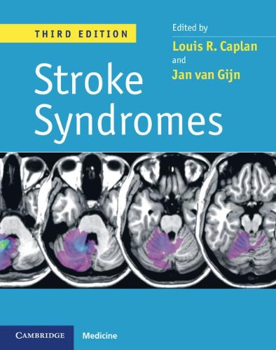 Stroke Syndromes, 3ed