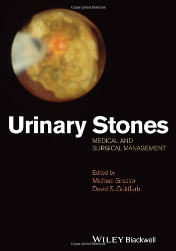 Urinary Stones