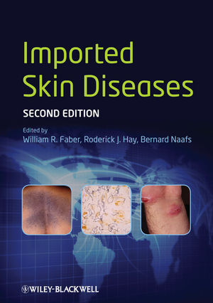 Imported skin diseases