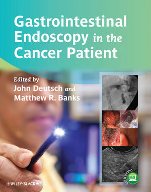 Gastrointestinal endoscopy in the cancer patient