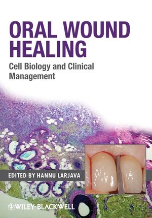 Oral wound healing : cell biology and clinical management