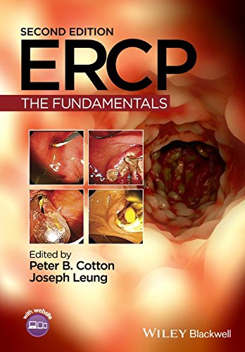 ERCP : the fundamentals
