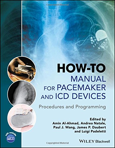 How-To Manual for Pacemaker and ICD Devices