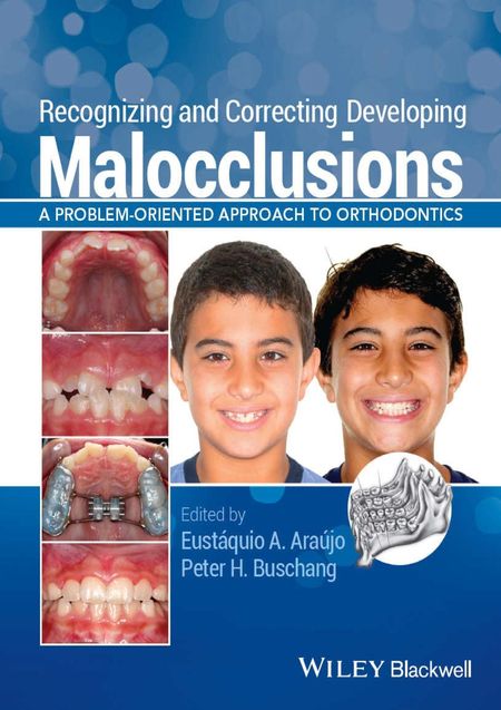 Recognizing and correcting developing malocclusions : a problem-oriented approach to orthodontics