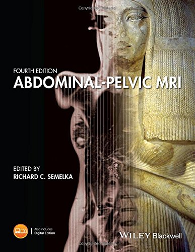 Abdominal-pelvic MRI