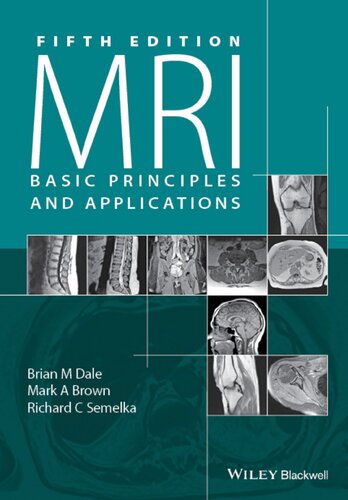 MRI