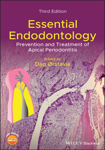 Essential endodontology : prevention and treatment of apical periodontitis