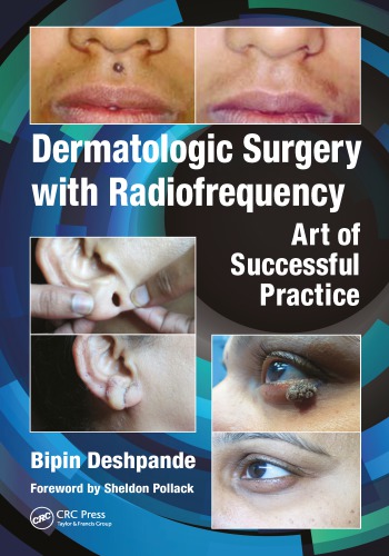 Dermatologic Surgery with Radiofrequency