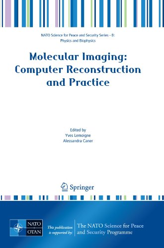 Molecular Imaging