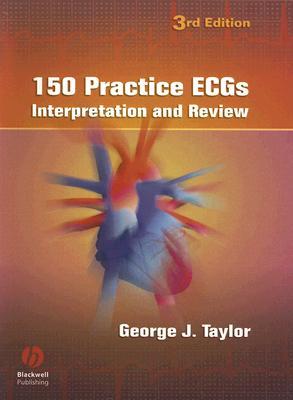 150 Practice Ecgs
