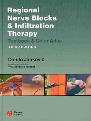 Regional Nerve Blocks and Infiltration Therapy
