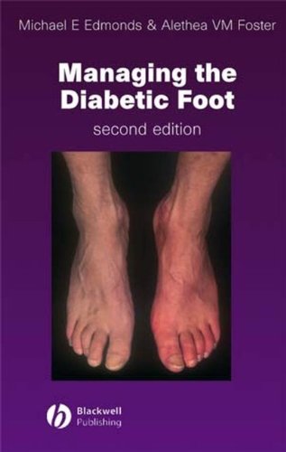 Managing the Diabetic Foot