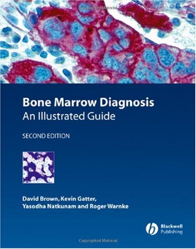 Bone Marrow Diagnosis
