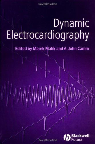 Dynamic Electrocardiography