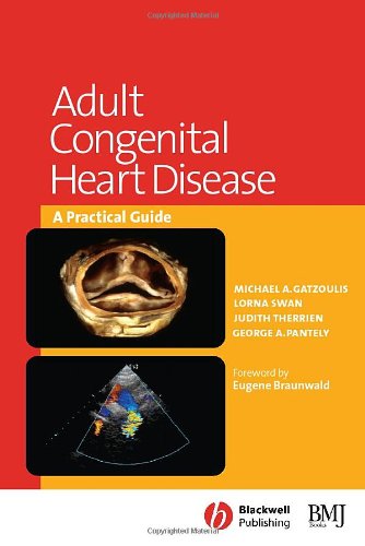 Adult Congenital Heart Disease