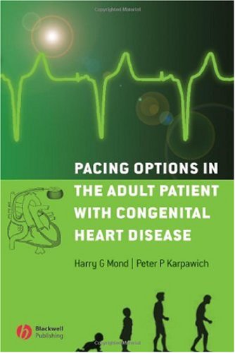 Pacing Options in the Adult Patient with Congenital Heart Disease