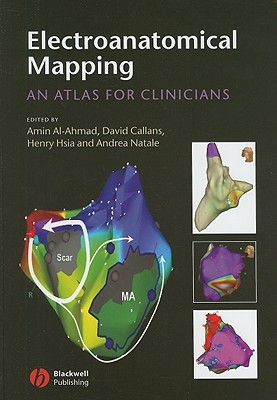 Electroanatomical Mapping