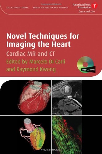 Novel Techniques for Imaging the Heart [With CDROM]