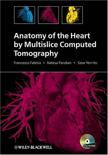 Anatomy Of The Heart By Multislice Computed Tomography