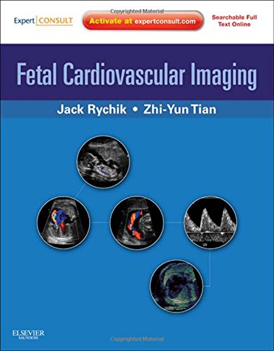 Fetal Cardiovascular Imaging [With Free Web Access]
