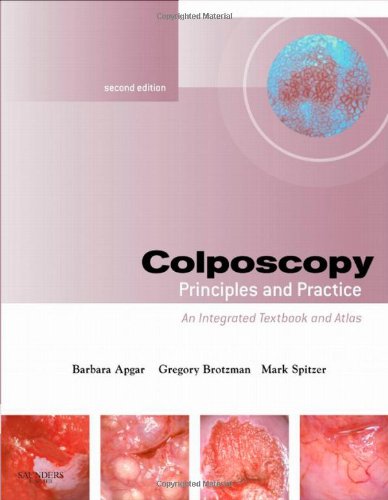 Colposcopy