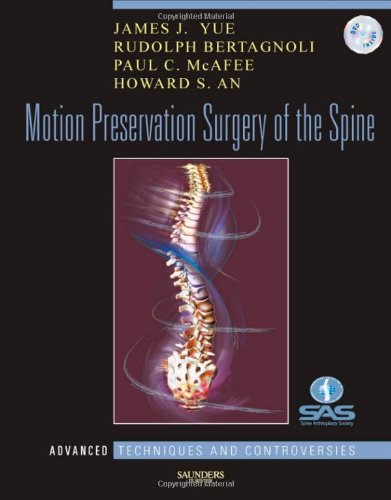 Motion Preservation Surgery of the Spine